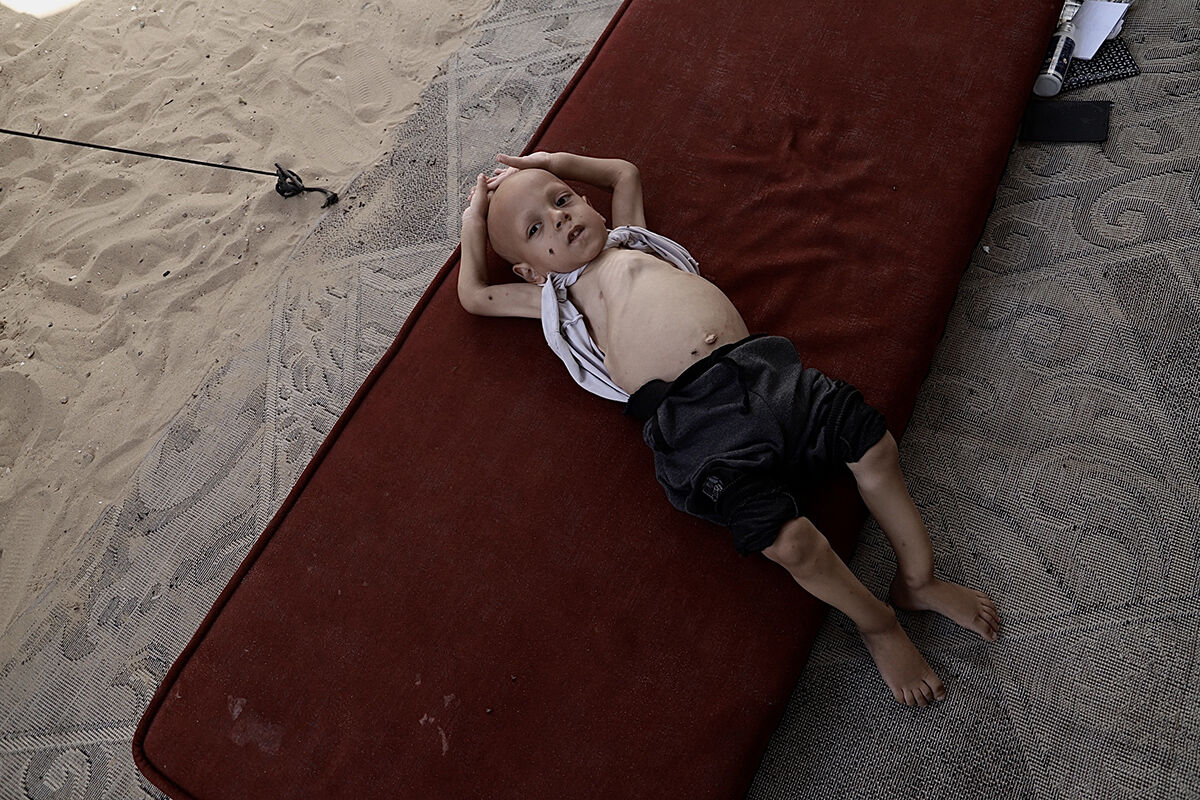 Çaresiz anne ne yapacağını şaşırdı! 5 yaşındaki çocuğu için çağrıda bulundu - 3. Resim