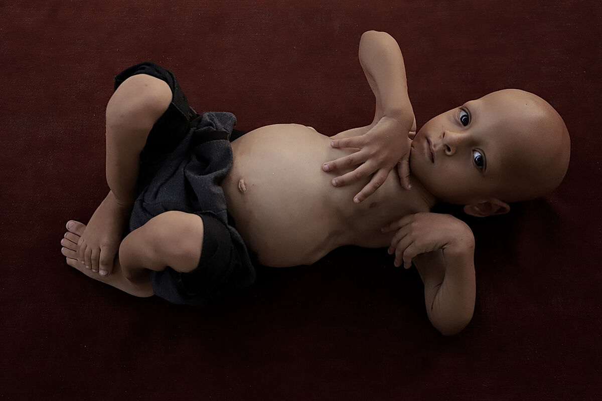 Çaresiz anne ne yapacağını şaşırdı! 5 yaşındaki çocuğu için çağrıda bulundu - 7. Resim