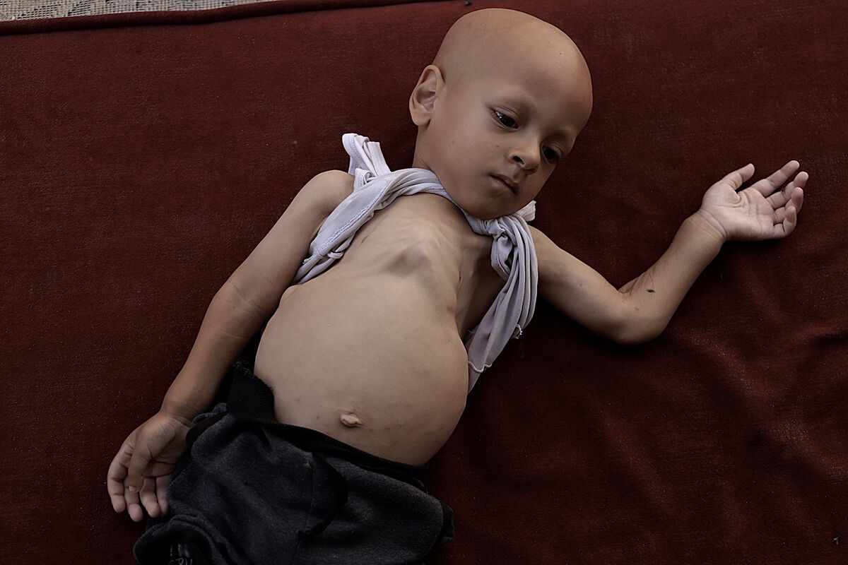 Çaresiz anne ne yapacağını şaşırdı! 5 yaşındaki çocuğu için çağrıda bulundu - 4. Resim