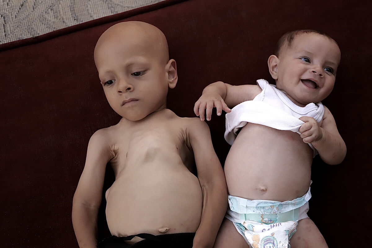 Çaresiz anne ne yapacağını şaşırdı! 5 yaşındaki çocuğu için çağrıda bulundu - 5. Resim