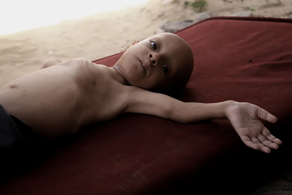 Çaresiz anne ne yapacağını şaşırdı! 5 yaşındaki çocuğu için çağrıda bulundu - 6. Resim