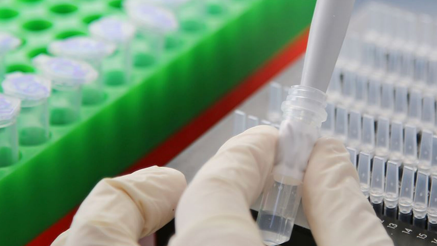 2025 Patoloji Laboratuvar Teknikleri Taban puanları belli oldu mu? İşte başarı sıralamaları - 2. Resim