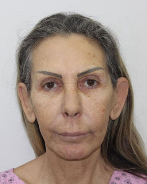 Petek Dinçöz’ün annesi estetik yaptırdı! Gören dönüp bir daha baktı - 2. Resim