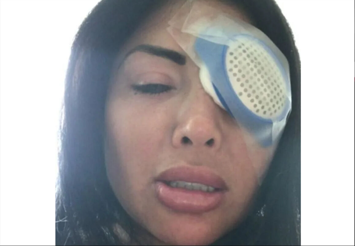 Renk ararken dünyanız kararmasın! Göz rengi değiştirme ameliyatı kör bırakabilir - 5. Resim