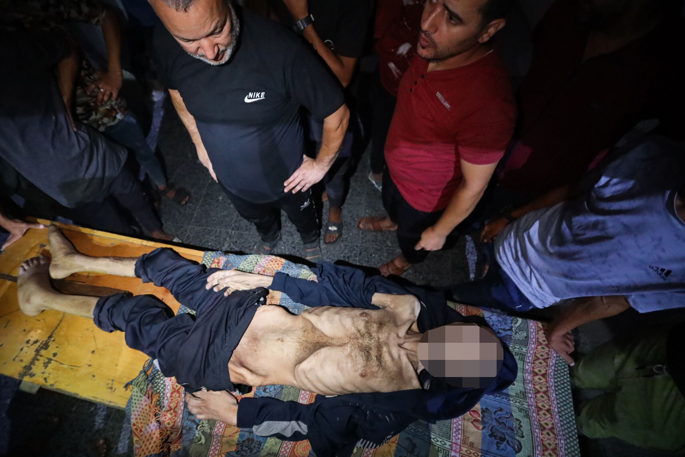 İnsanlığı utandıran kare! Açlık silahı bir can daha aldı, 35 yaşındaki adam bir deri bir kemik öldü - 2. Resim