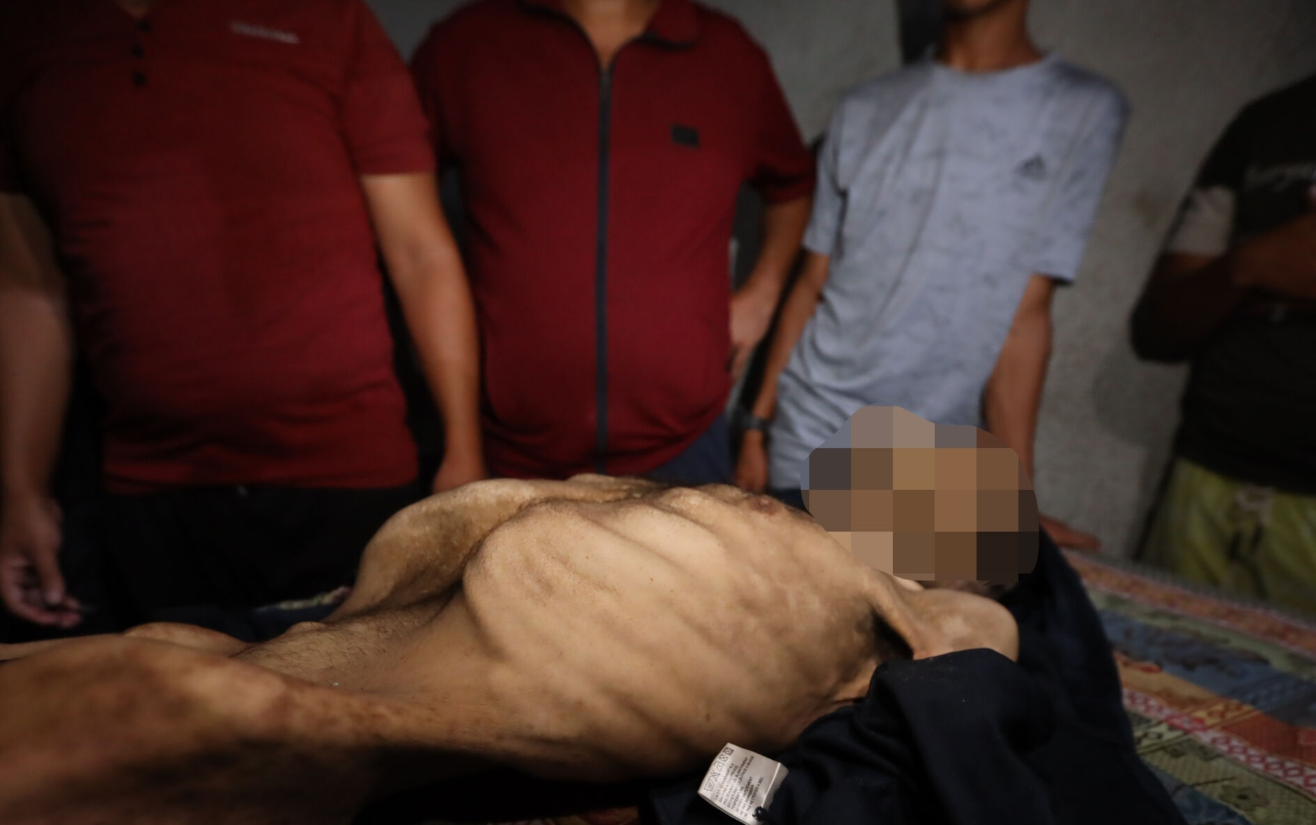 İnsanlığı utandıran kare! Açlık silahı bir can daha aldı, 35 yaşındaki adam bir deri bir kemik öldü - 1. Resim