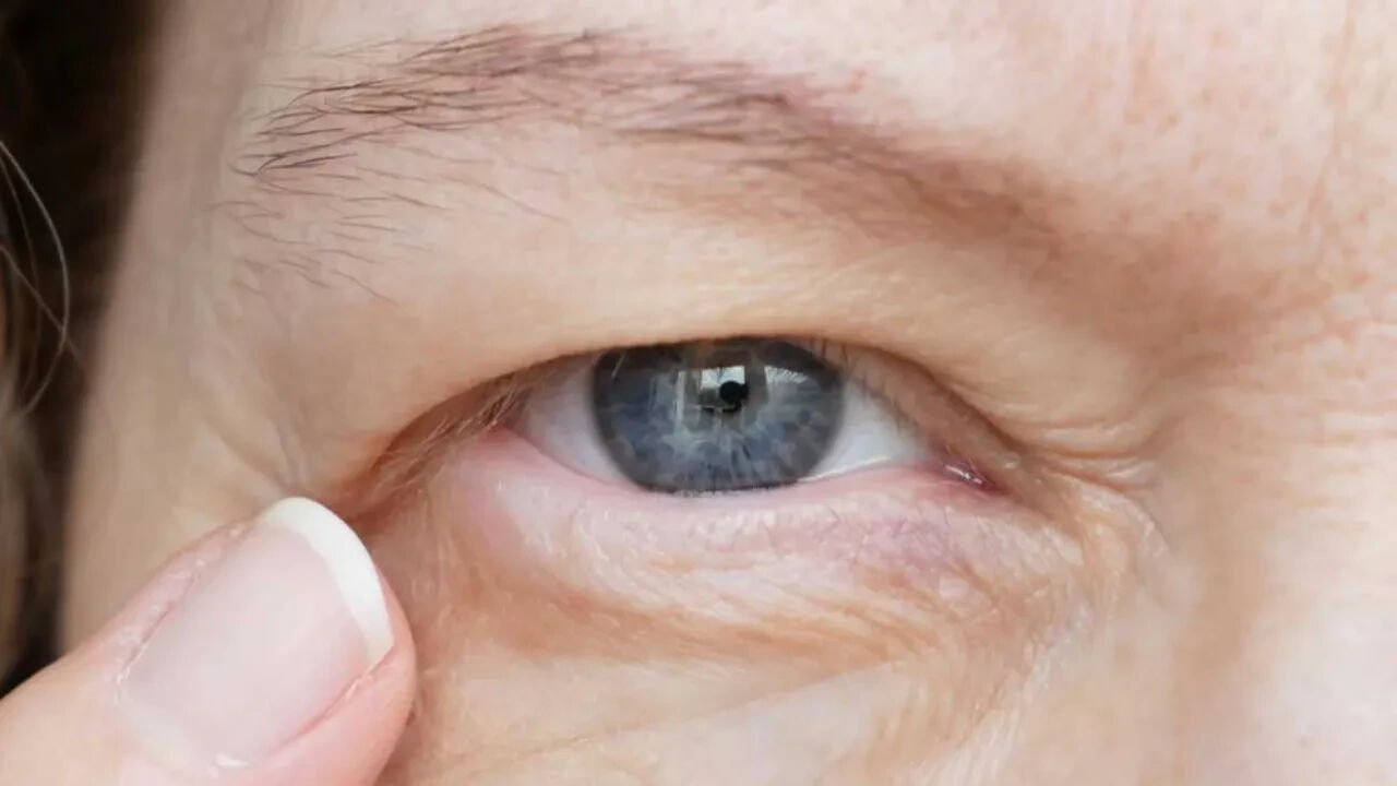 Seğirmeyi hafife almayın! Gözleriniz vücudunuzun alarmını veriyor olabilir... - 2. Resim