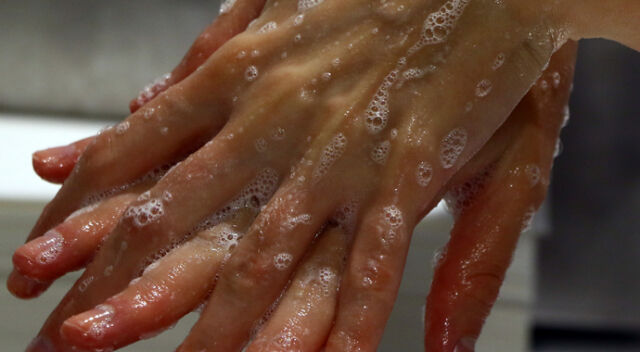 Tatiliniz kabusa dönüşebilir! Sıcak hava gıda zehirlenmelerini arttırdı... Uzmanlar iki gıdanın altını çizdi - 1. Resim