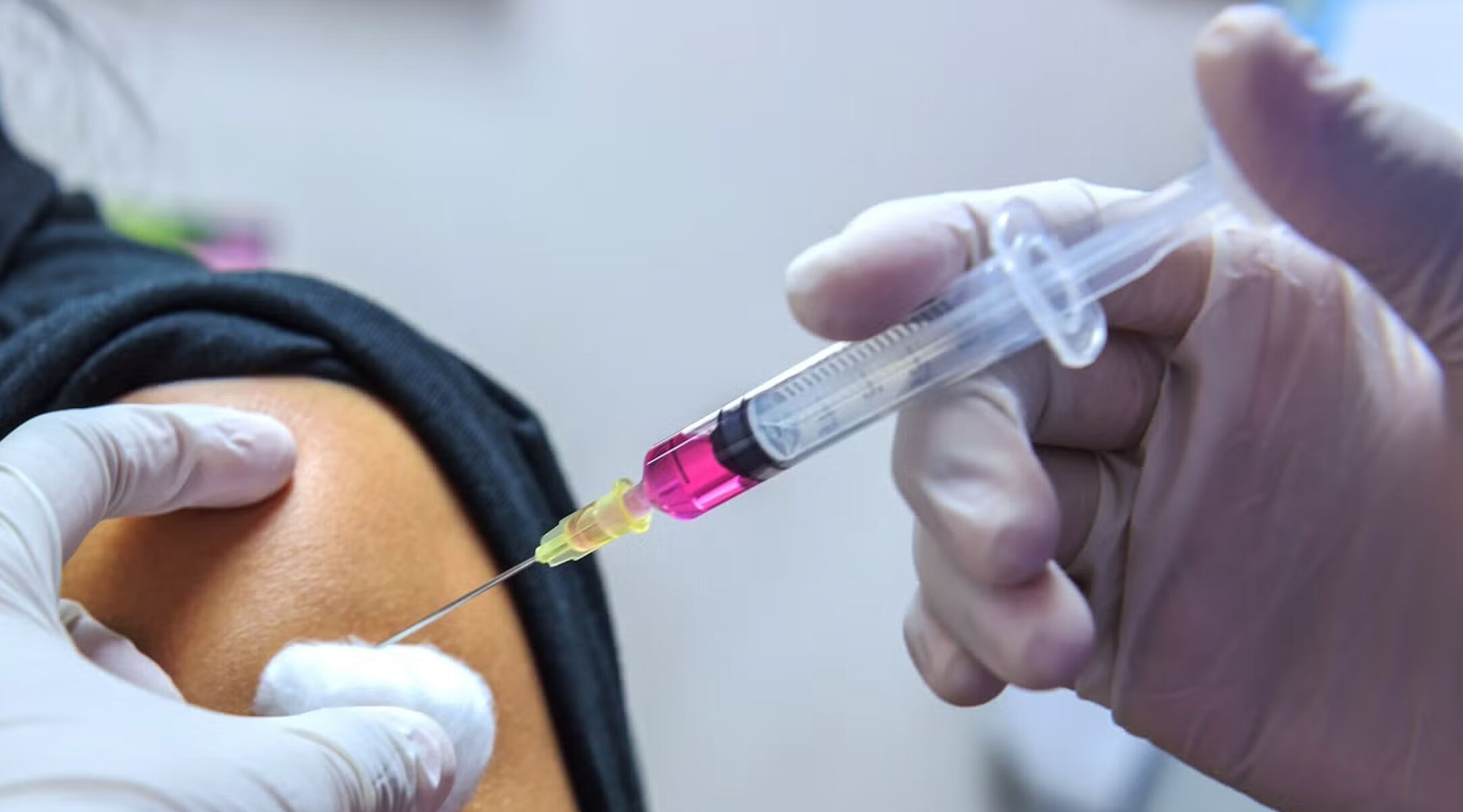 Chikungunya virus belirtileri neler, aşısı var mı, neyden ve nasıl bulaşır? Chikungunya virus belirtileri neler, aşısı var mı, neyden ve nasıl bulaşır? - 2. Resim