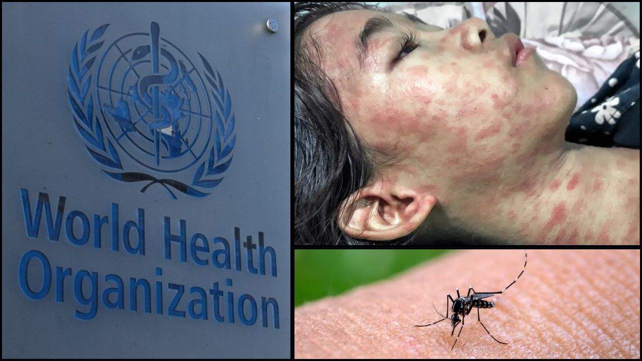 Chikungunya virus nedir, bulaşıcı mı, ölümcül mü? Dünya Sağlık Örgütü uyardı! Chikungunya virus nedir, bulaşıcı mı, ölümcül mü? Dünya Sağlık Örgütü uyardı!