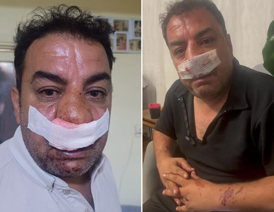 Turistleri savundu, üstüne çullandılar! Kartepe'de dolandırıcılığı önleyen şoför hastanelik oldu Turistleri savundu, üstüne çullandılar! Kartepe'de dolandırıcılığı önleyen şoför hastanelik oldu - 2. Resim