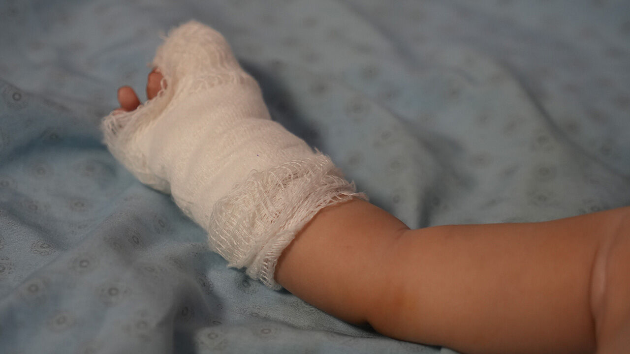 Hastanede büyük skandal! 3 aylık bebeğin parmağı koptu Hastanede büyük skandal! 3 aylık bebeğin parmağı koptu - 3. Resim