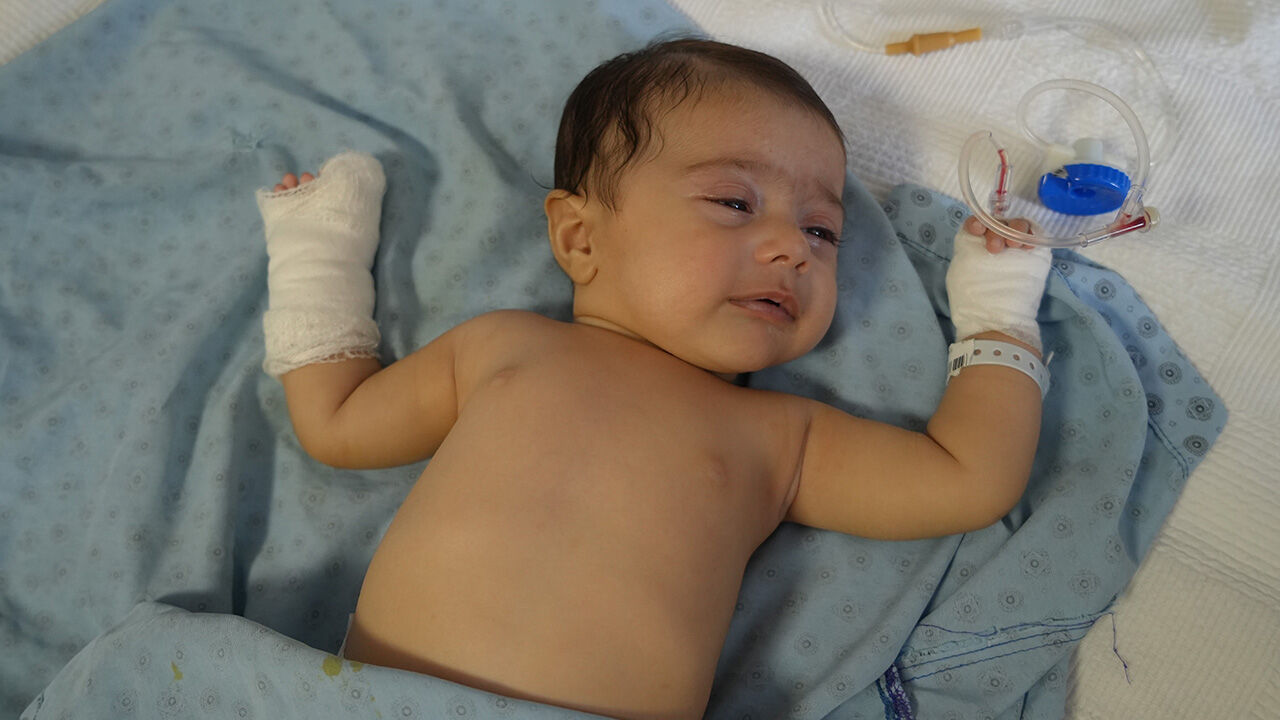 Hastanede büyük skandal! 3 aylık bebeğin parmağı koptu Hastanede büyük skandal! 3 aylık bebeğin parmağı koptu - 1. Resim