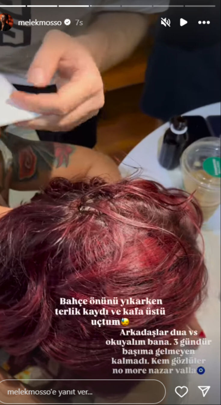 Talihsiz kaza! Ünlü şarkıcı Melek Mosso kafa üstü düştü: “Lütfen dua edin" Talihsiz kaza! Ünlü şarkıcı Melek Mosso kafa üstü düştü: “Lütfen dua edin" - 3. Resim
