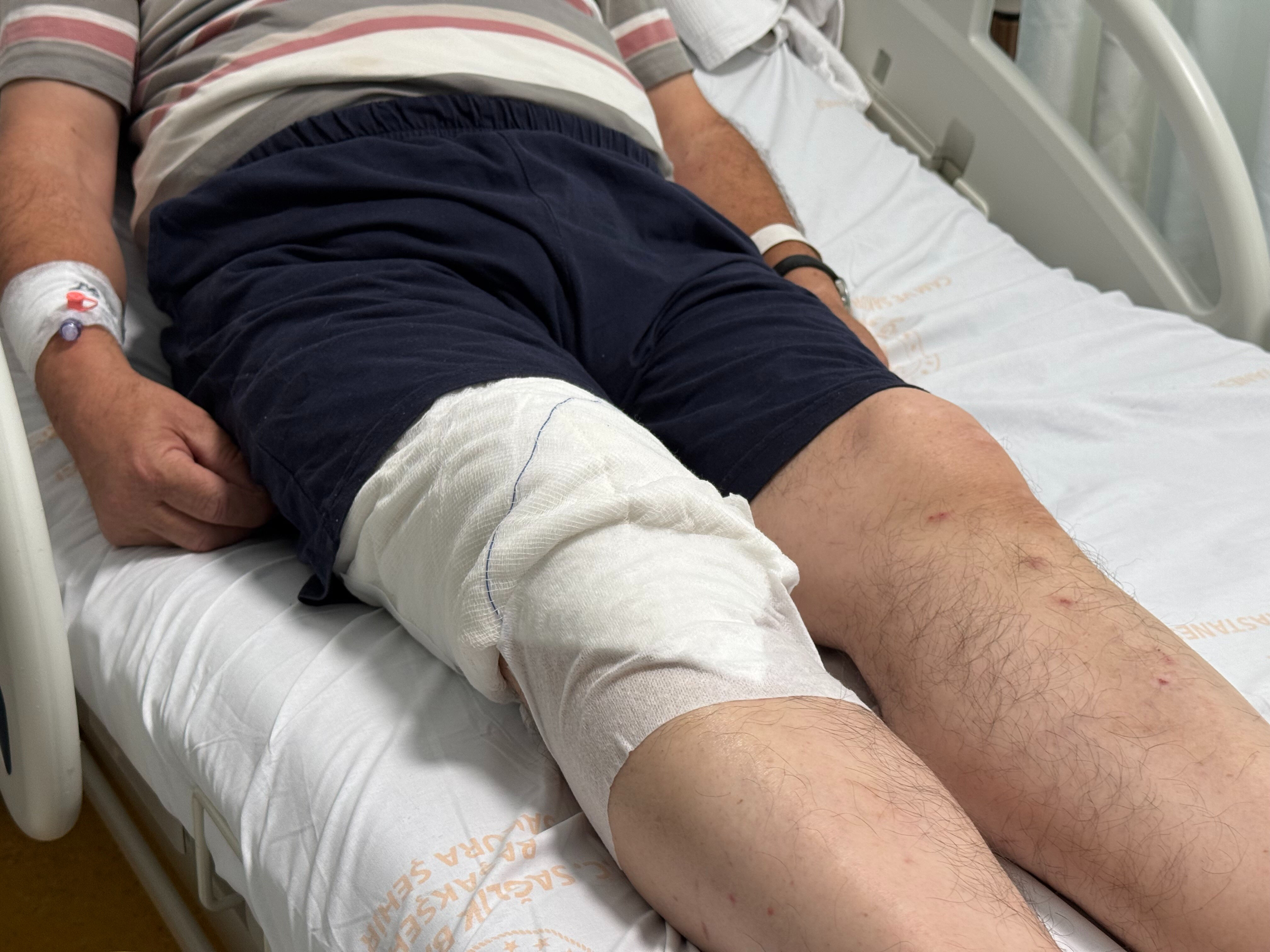 Mutfakta korkunç kaza! 70 yaşındaki adam apar topar hastaneye kaldırıldı - 2. Resim