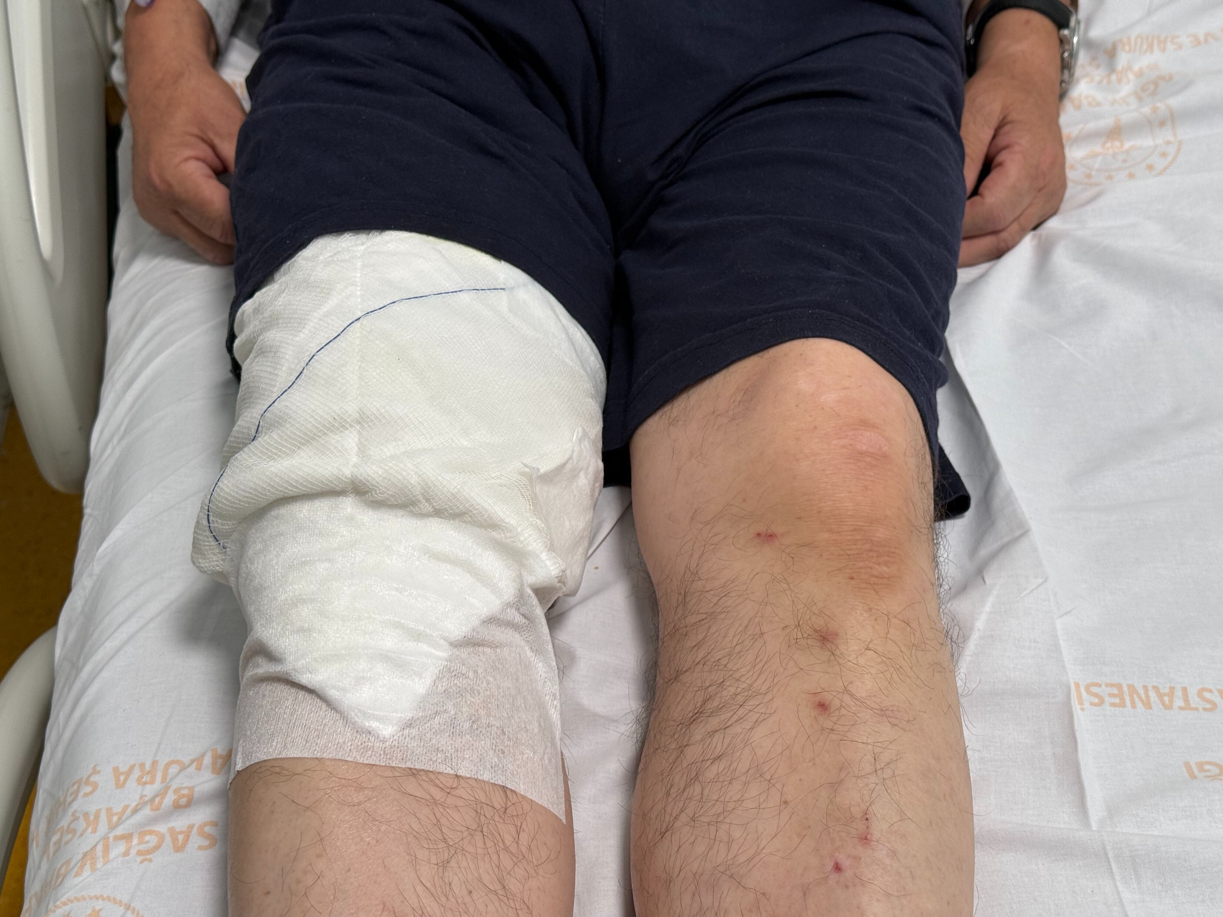 Mutfakta korkunç kaza! 70 yaşındaki adam apar topar hastaneye kaldırıldı - 1. Resim