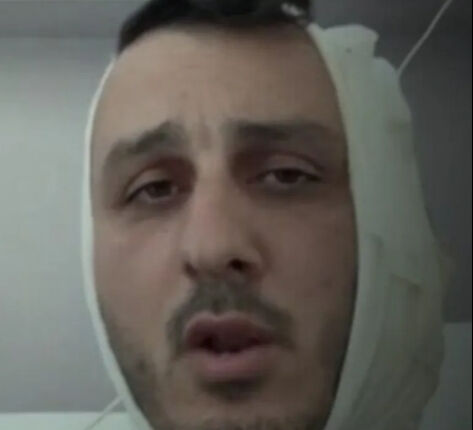 İsrailli turistin tatil keyfi kısa sürdü! Kulağını kopardılar İsrailli turistin tatil keyfi kısa sürdü! Kulağını kopardılar - 1. Resim