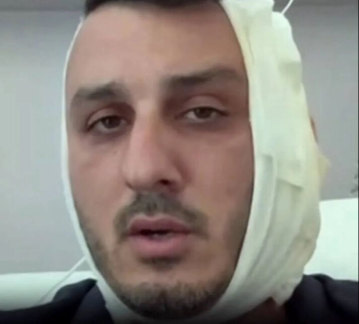 İsrailli turistin tatil keyfi kısa sürdü! Kulağını kopardılar İsrailli turistin tatil keyfi kısa sürdü! Kulağını kopardılar - 2. Resim