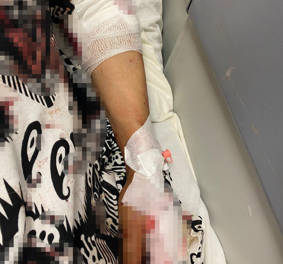 Abdest almaya bahçeye çıktı, sokak köpekleri hastanelik etti - 1. Resim