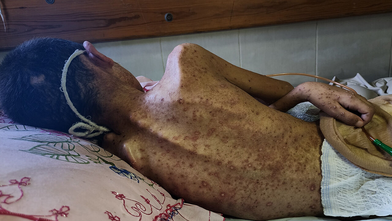 ABD basını İsrail'in katlettiği çocukları tek tek yazdı: Utancın listesi kahretti! hasta