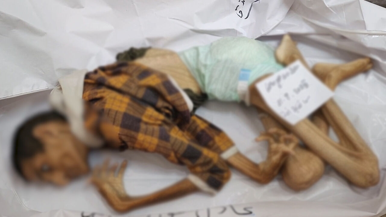 Bu acıya yürek dayanmaz... Görenlerin içini sızlattı! 27 yaşında açlıktan 15 kiloya düştü Görenlerin içini sızlattı! 27 yaşında 15 kiloya düştü - 3. Resim