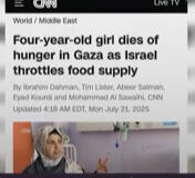 İsrail televizyonunda mide bulandıran yayın! Gazze'de açlıktan ölenlerle böyle alay ettiler - 3. Resim