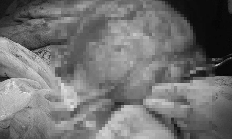 Karın ağrısıyla gitti, karnından dev kitle çıktı! “Ben de beklemiyordum” Karın ağrısıyla gitti, karnından dev kitle çıktı! “Ben de beklemiyordum” - 3. Resim