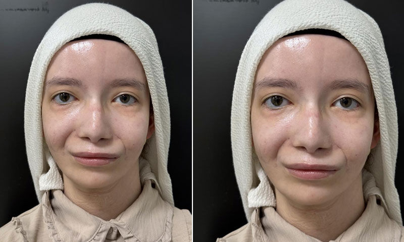 Türk doktorlar tarih yazdı! Kübra Nur 23 yıl sonra ilk kez gülümsedi Türk doktorlar tarih yazdı! Kübra Nur 23 yıl sonra ilk kez gülümsedi - 3. Resim