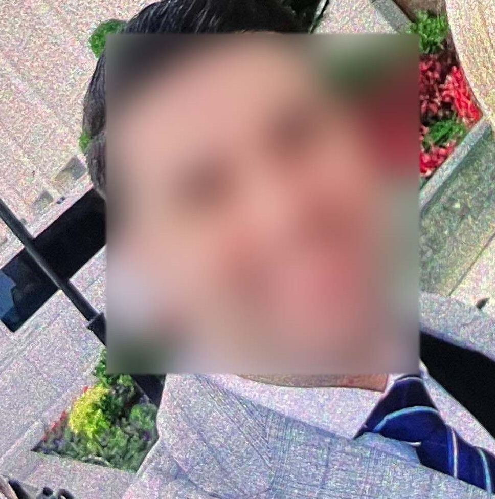 Uzaklaştırma kararı aldırdığı eşi, kırılmadık kemiğini bırakmadı! Eli paramparça, kafatasında zımbalar... - 5. Resim