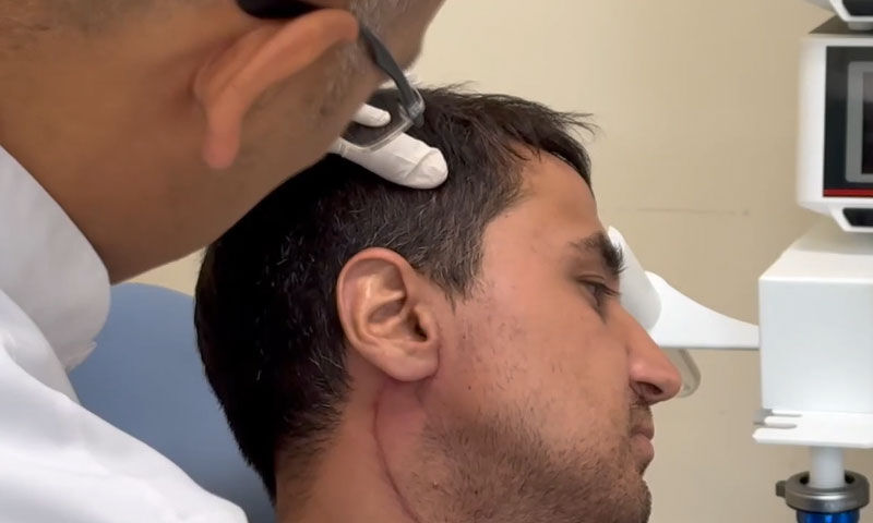 Boyundaki şişlik şikayetiyle başvurdu!  15 yıl sonra nedeni ortaya çıktı, kendisi de şaşırdı - 2. Resim