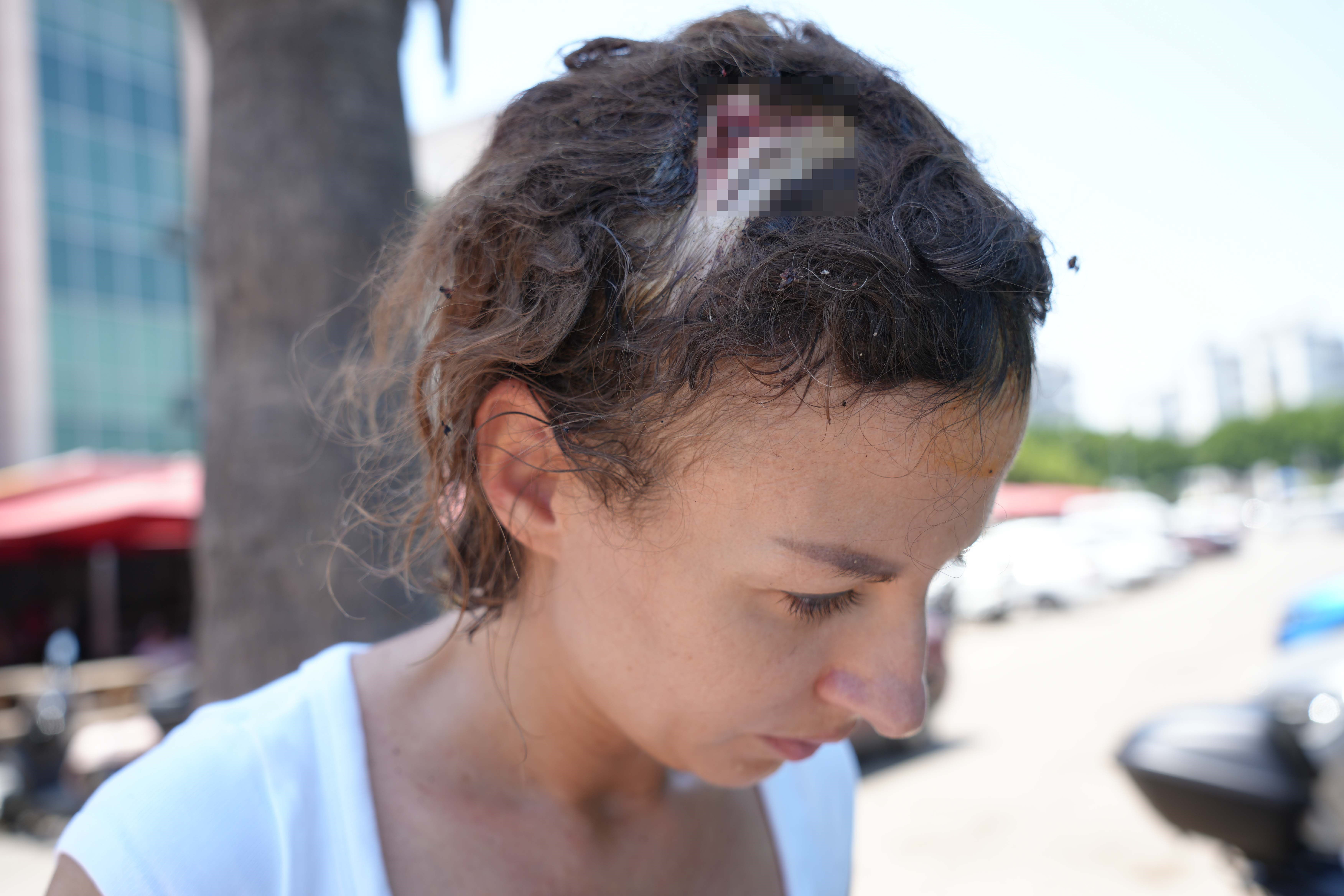 Uzaklaştırma kararı aldığı eşi dehşeti yaşatmıştı... Yaşadığı korkuyu anlattı! "Kapattım, o vurmaya devam etti" Uzaklaştırma kararı aldığı eşi dehşeti yaşatmıştı... Yaşadığı korkuyu anlattı! "Kapattım, o vurmaya devam etti" - 4. Resim