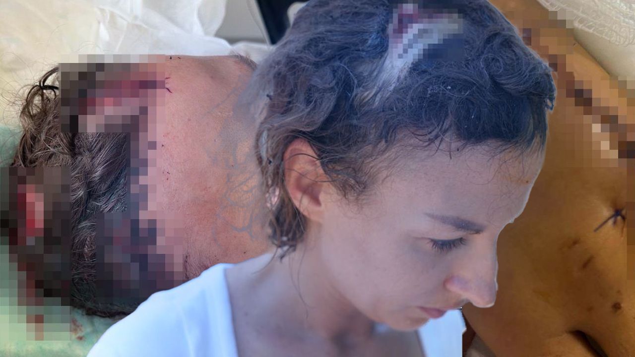 Uzaklaştırma kararı aldığı eşi dehşeti yaşatmıştı... Yaşadığı korkuyu anlattı! "Kapattım, o vurmaya devam etti" Uzaklaştırma kararı aldığı eşi dehşeti yaşatmıştı... Yaşadığı korkuyu anlattı! "Kapattım, o vurmaya devam etti"