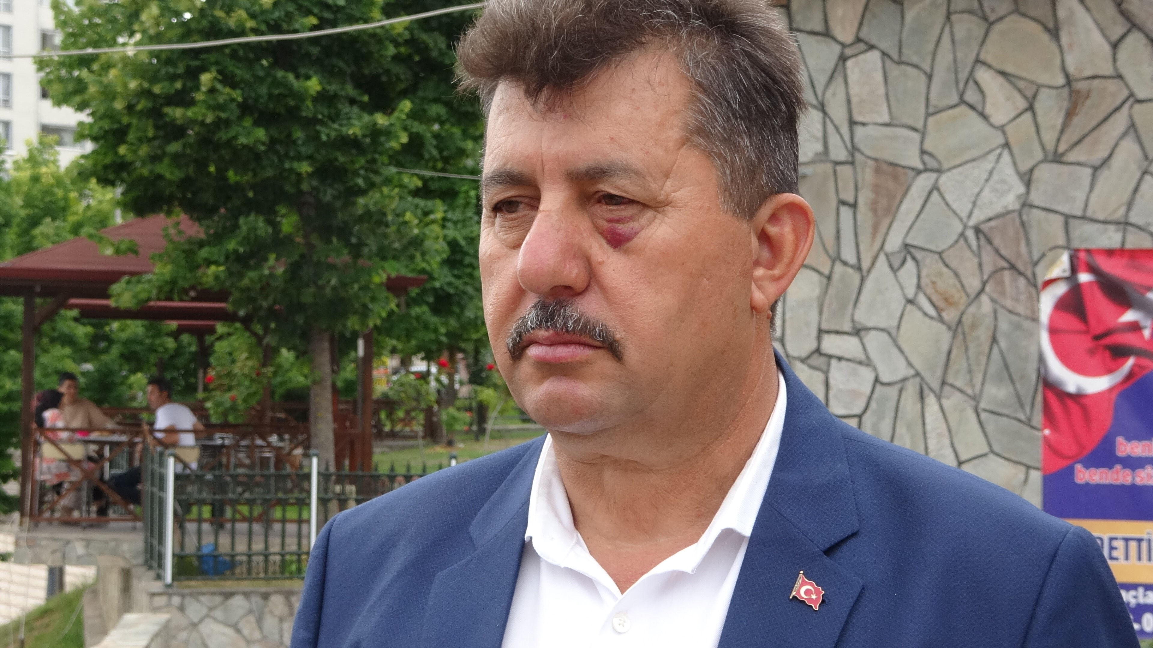 Parktaki çiftin uygunsuz hareketlerini uyaran muhtarın başına gelmeyen kalmadı! "Bıçağı vurunca 8 dikiş atıldı" Parktaki çiftin uygunsuz hareketlerini uyaran muhtarın başına gelmeyen kalmadı! "Bıçağı vurunca 8 dikiş atıldı" - 3. Resim