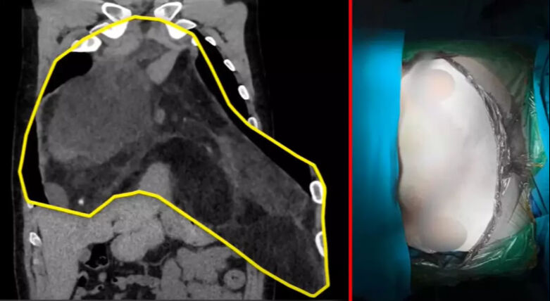 Türkiye'de bilinen ve bildirilen en büyük vaka! Kendisi bile inanamadı - 2. Resim