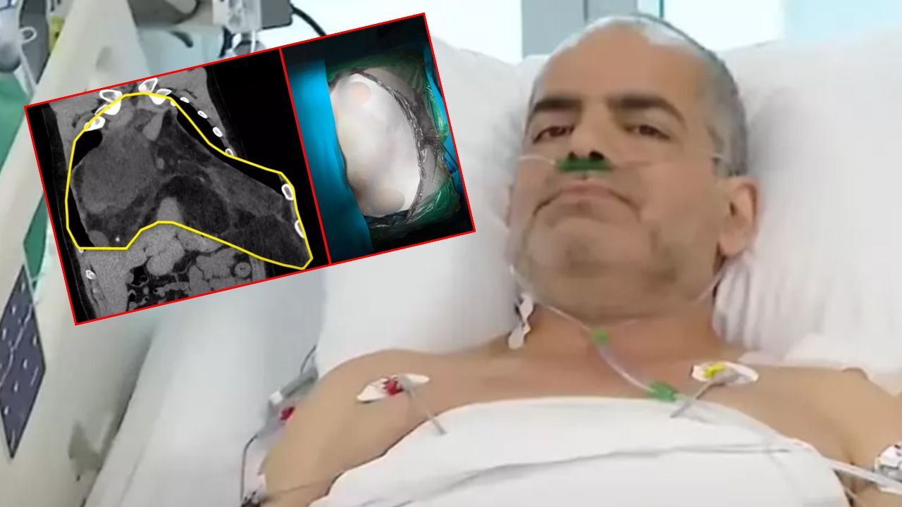 Türkiye'de bilinen ve bildirilen en büyük vaka! Kendisi bile inanamadı Türkiye'de bilinen ve bildirilen en büyük vaka! Kendisi bile inanamadı