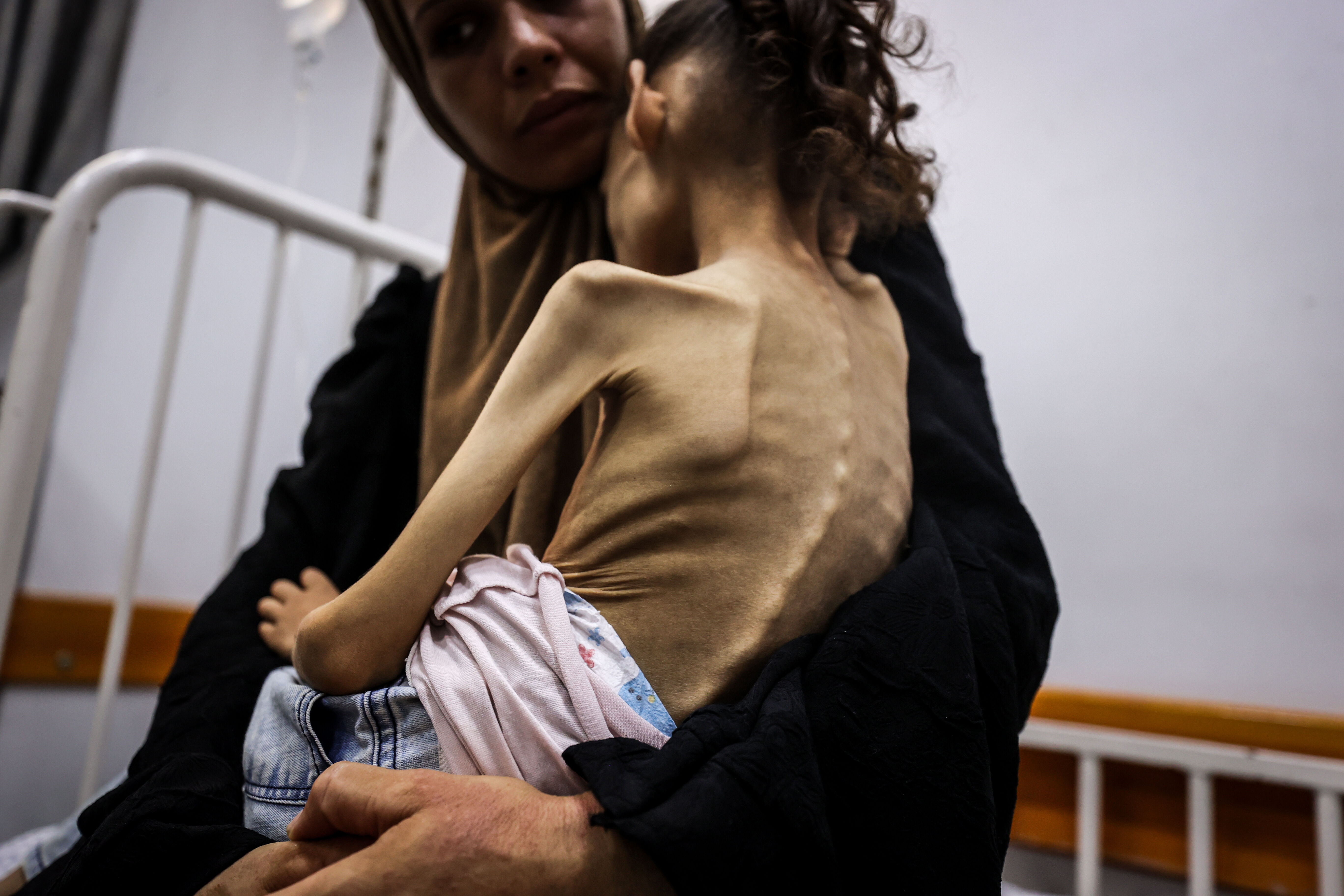 25 kilodan 10 kiloya düştü... Küçük Meryem, dünyanın gözleri önünde açlıktan eriyor 25 kilodan 10 kiloya düştü... Küçük Meryem, dünyanın gözleri önünde açlıktan eriyor - 1. Resim