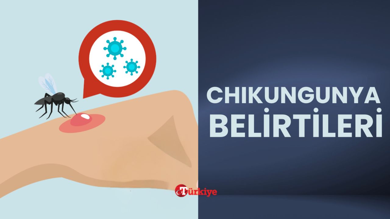 Chikungunya Virus nasıl bulaşır, ölümcül mü? Chikungunya Virüs belirtileri Chikungunya Virus nasıl bulaşır, ölümcül mü? Chikungunya Virüs belirtileri