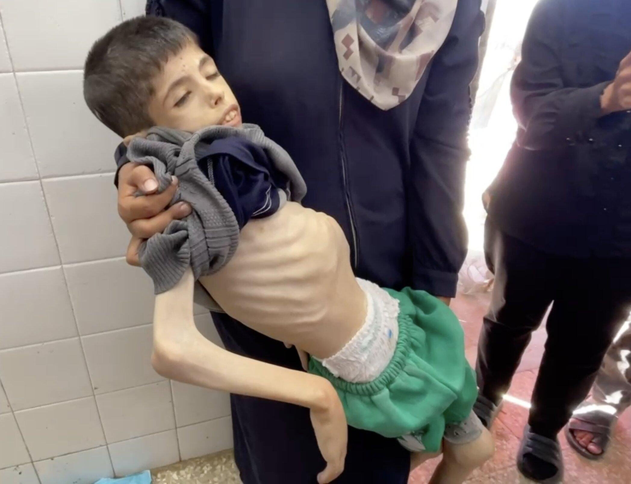 Ekmek dahi bulamadılar, günden güne eridi! 13 yaşındaki Şuhaybir annesinin kollarında açlıktan öldü Ekmek dahi bulamadılar, günden güne eridi! 13 yaşındaki Şuhaybir annesinin kollarında açlıktan öldü - 2. Resim