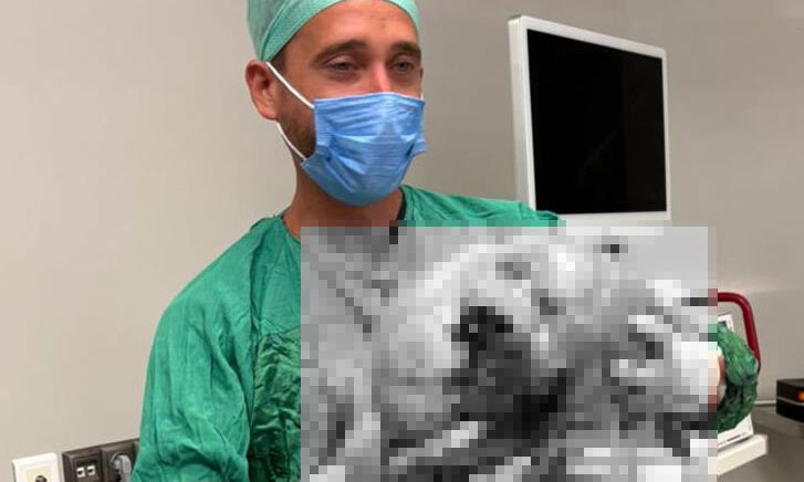 Karın ağrısı sandı, 4 kilo kitle taşıdığı ortaya çıktı Karın ağrısı sandı, 4 kilo kitle taşıdığı ortaya çıktı - 1. Resim