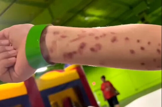 Akvaryumda facia! Dev ahtapot 6 yaşındaki çocuğun kolunu kaptı, o anlar sosyal medyayı salladı Akvaryumda facia! Dev ahtapot 6 yaşındaki çocuğun kolunu kaptı, o anlar sosyal medyayı salladı - 3. Resim