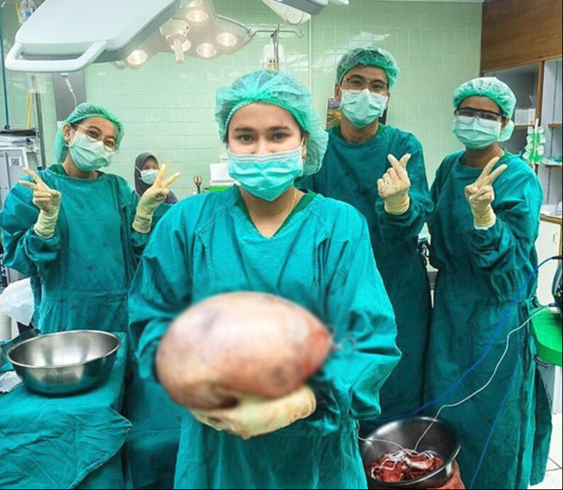 Şişkinlik ve nefes alamama şikayetiyle başvurmuştu! Karnından çıkan doktorları bile hayrete düşürdü Şişkinlik ve nefes alamama şikayetiyle başvurmuştu! Karnından çıkan doktorları bile hayrete düşürdü - 1. Resim