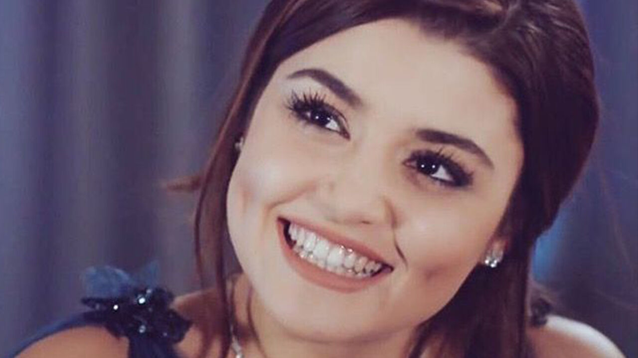 Estetik ameliyat akımlarında son nokta! Yapay gamze çılgınlığı - 2. Resim