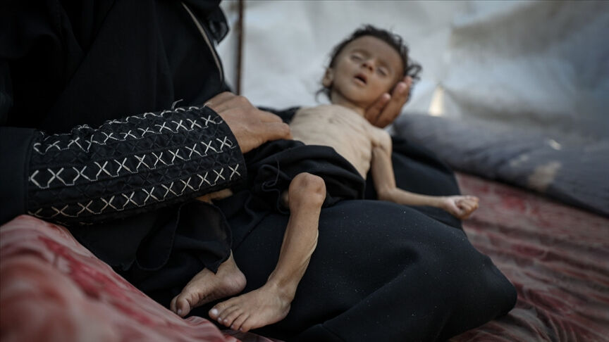 İsrail'in açlık silahının gölgesinde  2’si çocuk 11 kişi daha hayatını kaybetti - 2. Resim