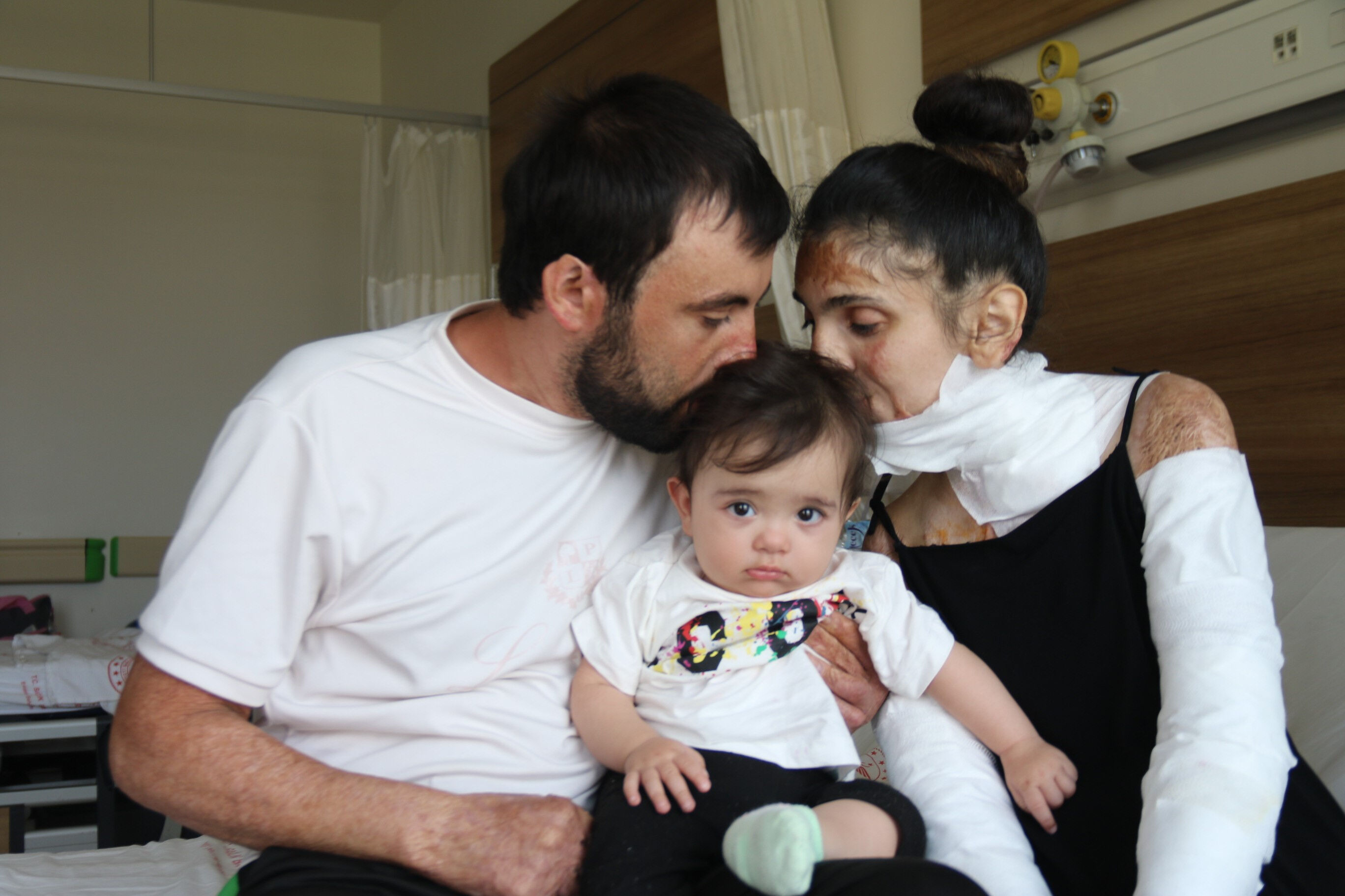 Düğüne 3 gün kala dehşeti yaşadılar! Patlamada kapanan elleri 3 yıl sonra yeniden kavuştu! - 3. Resim