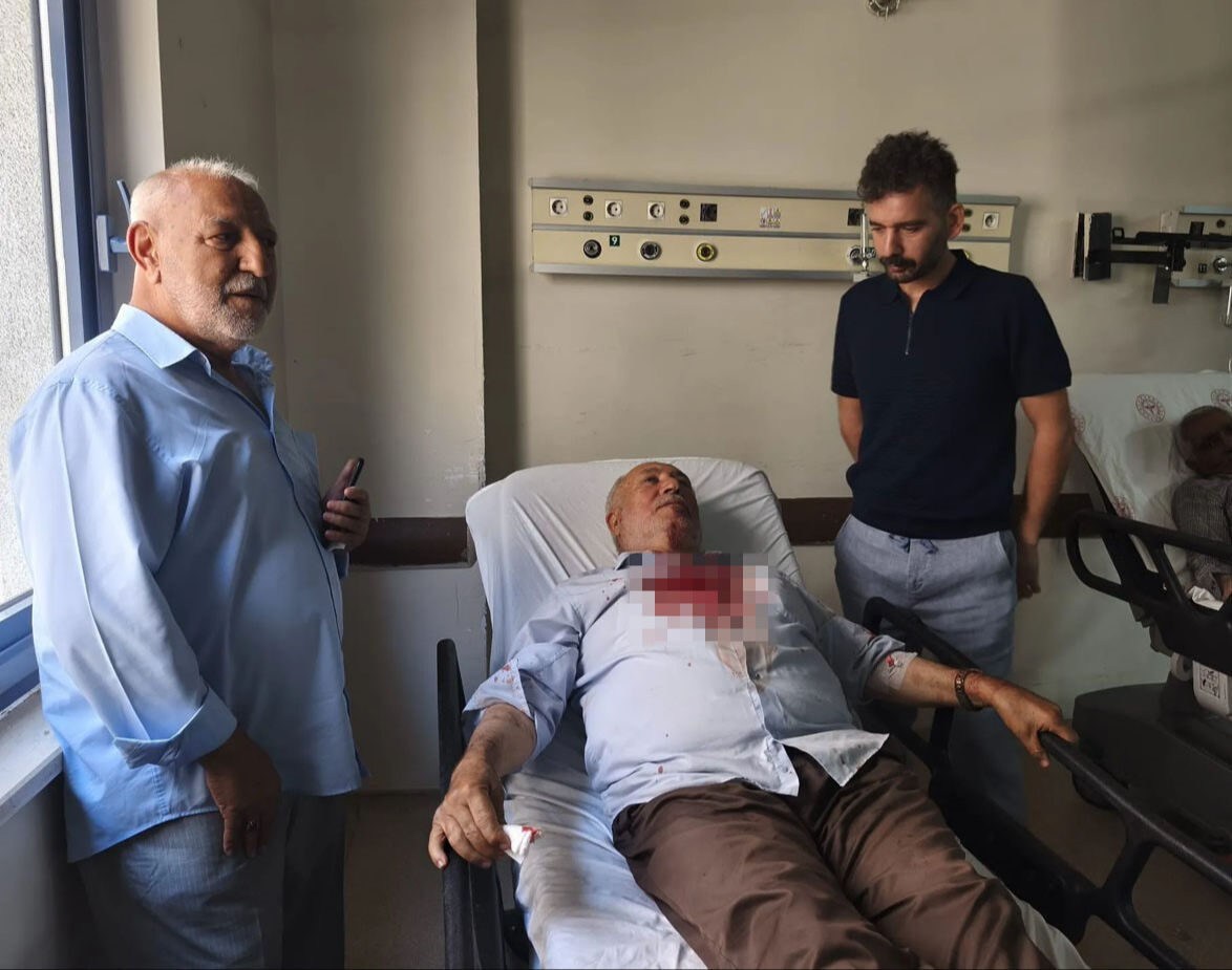 Cami bahçesi karıştı, kavgayı ayıran imam hastanelik oldu - 1. Resim