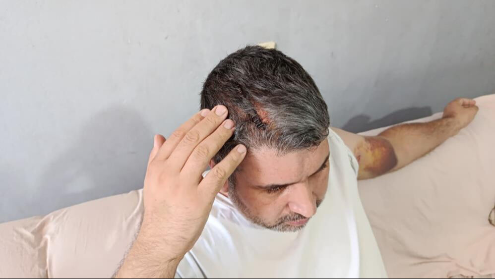 Miras için yeğenini acımasızca darbetmişti! Dayının savunması 