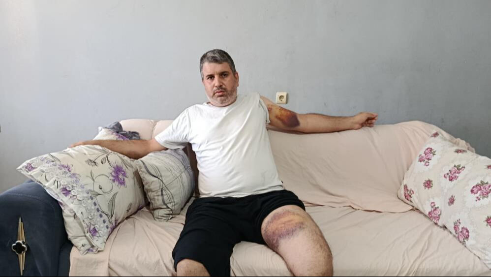 Miras için yeğenini acımasızca darbetmişti! Dayının savunması 