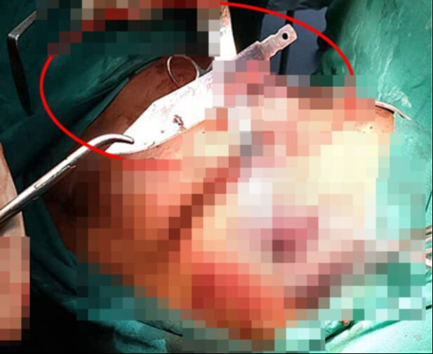 Göğüs ağrısı şikayetiyle gitmişti! Gerçek hastanede ortaya çıktı: Meğer 8 yıldır... - 2. Resim