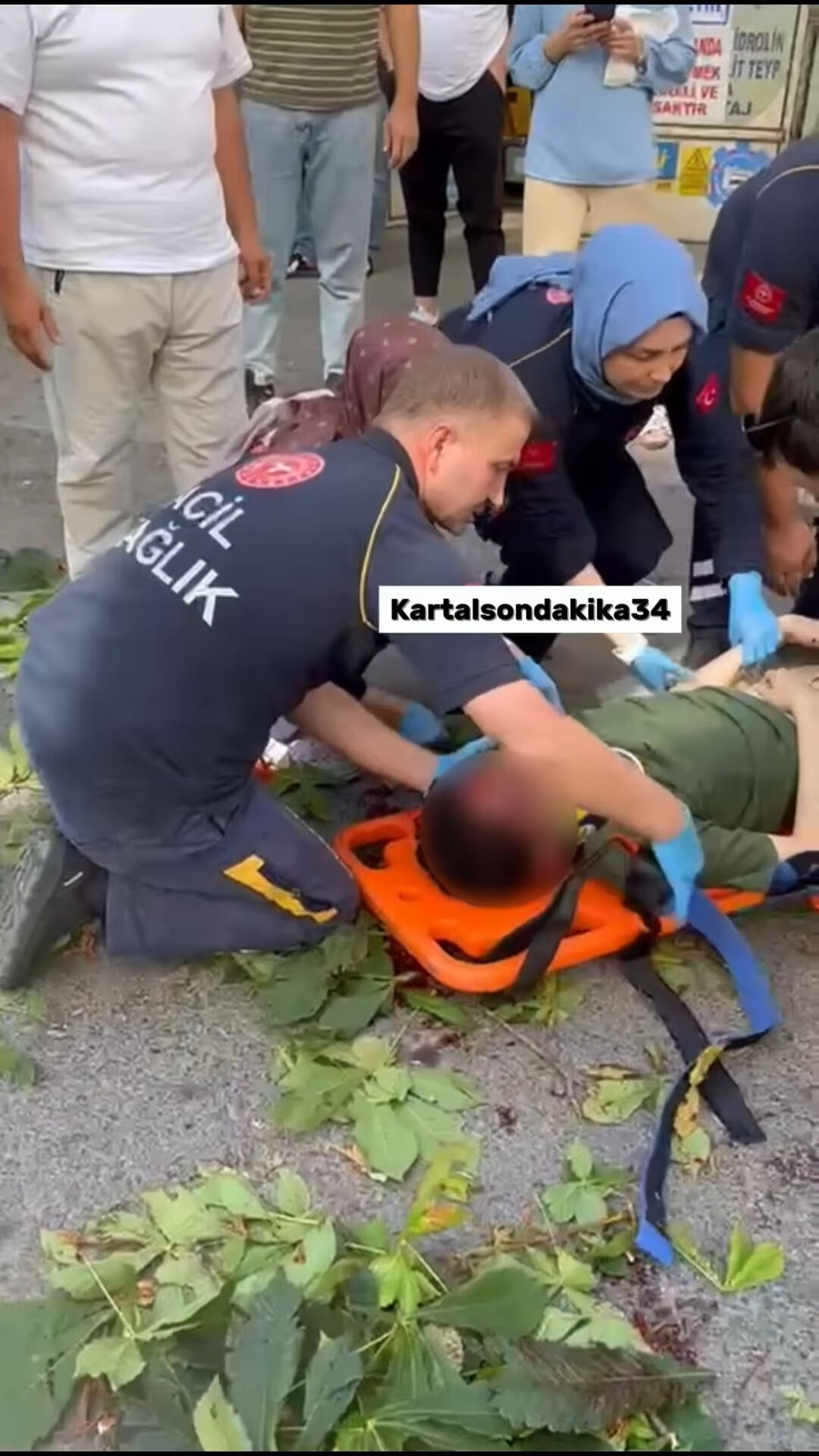 Duy Beni’nin yıldızı İbrahim Yıldız’ın üzerine ağaç devrildi! Komadaki genç oyuncudan haber var - 2. Resim