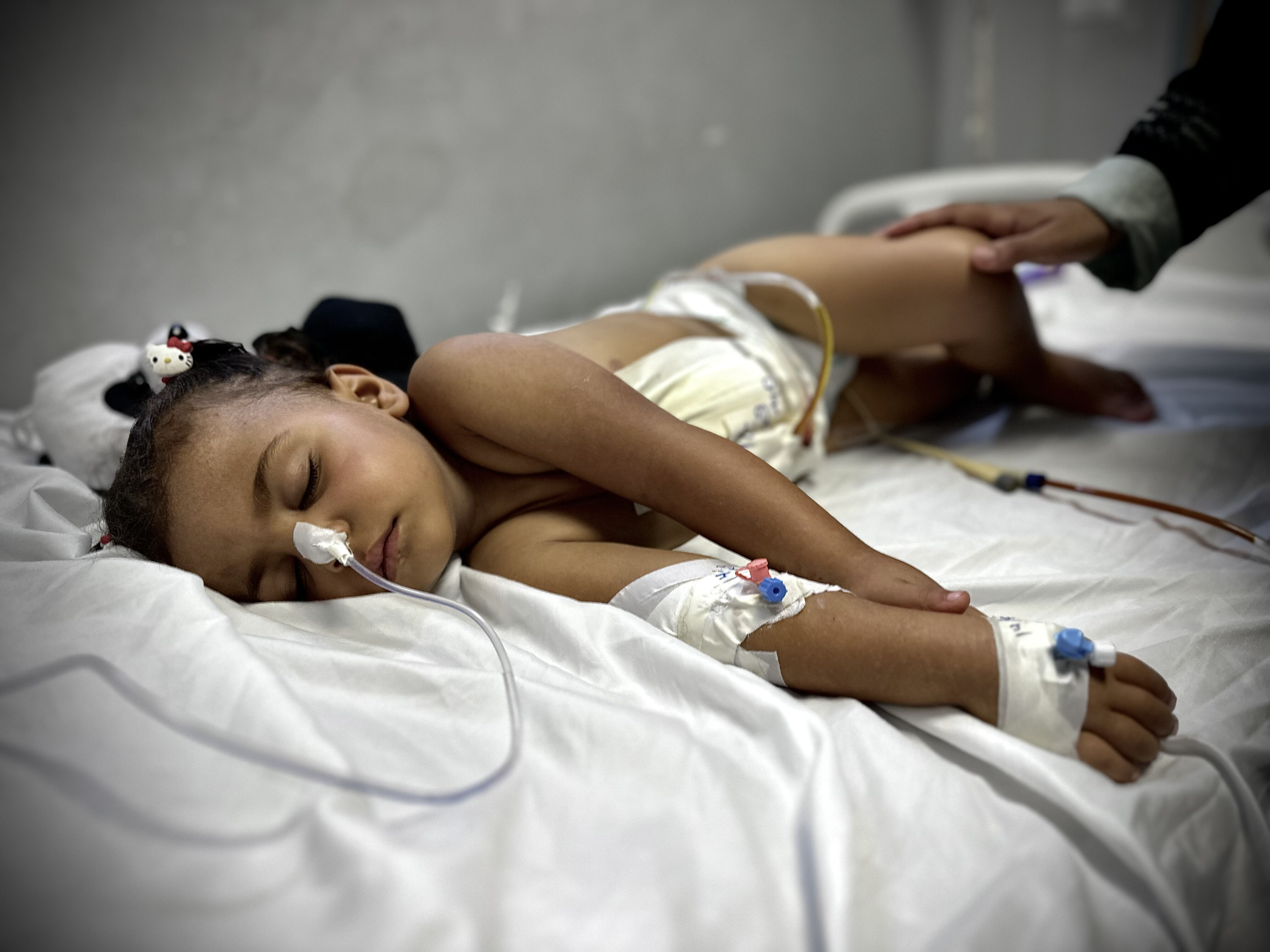 İsrail'in bombaları oyun oynarken iç organlarını deldi! Gazzeli minik Cumana Neccar tedavi edilmeyi bekliyor - 2. Resim